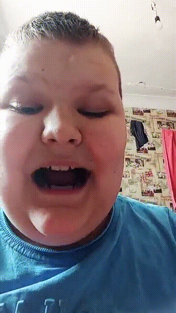 Рома срёт ртом